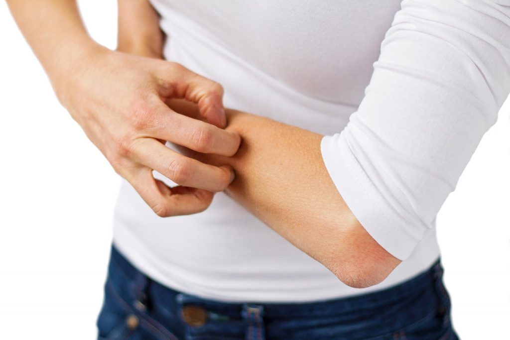 Why do you have dry itchy skin in the winter?