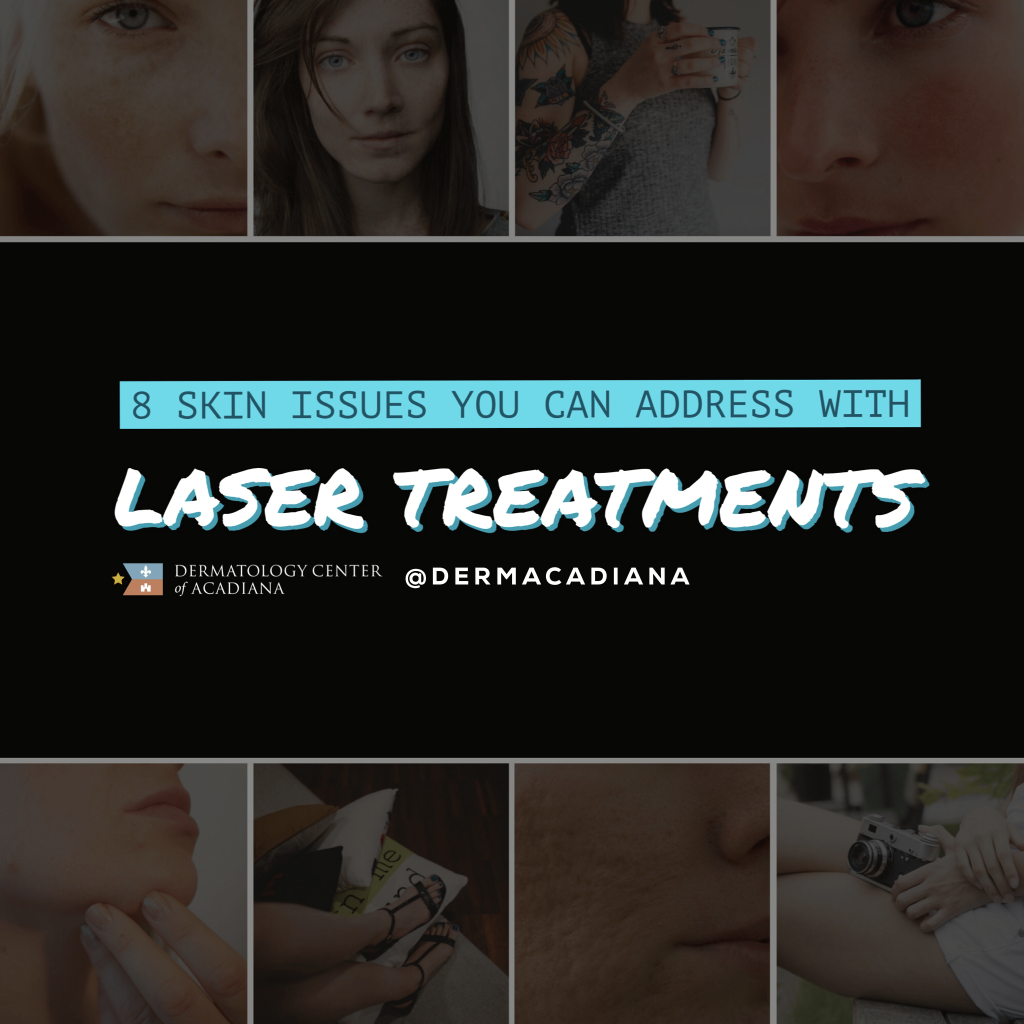 Laser Treatments Lafayette Acadiana Louisiana